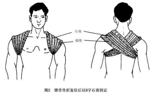 锁骨在哪个位置示意图