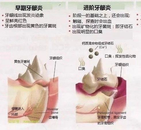 你家猫的牙龈发炎了？谈谈80%的猫都可能得的牙周病